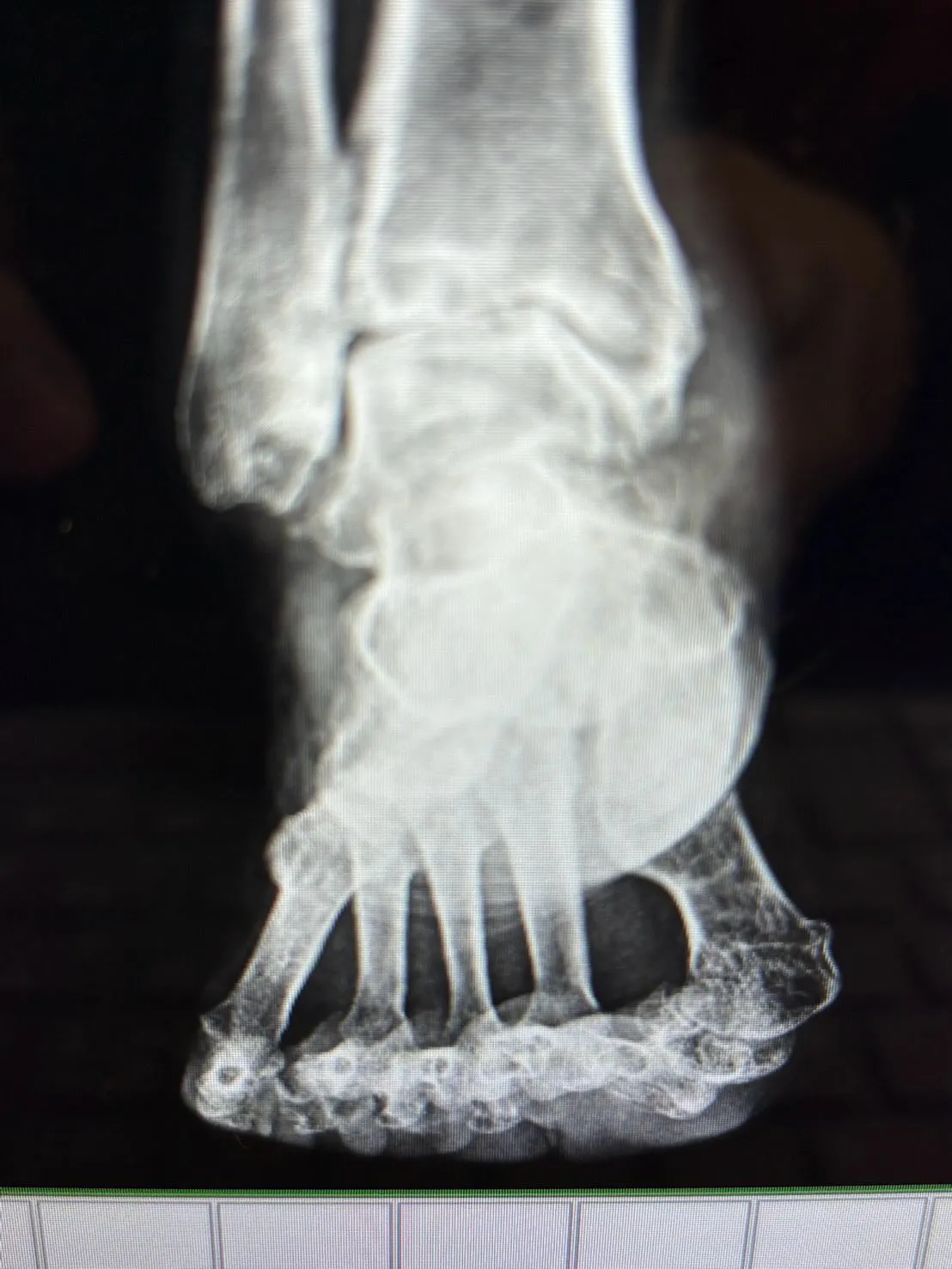 通っているお客様のレントゲン🩻